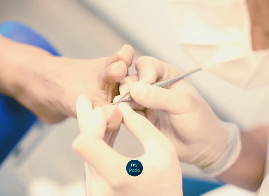 L'Histoire de la profession de Pédicure-Podologue : Un voyage à travers les Âges - My Podologie