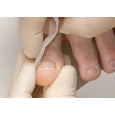 B/S Quick tabs x5 - My Podiatry