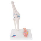 Mini articolazione del ginocchio con sezione trasversale, su base - Anatomia e patologia