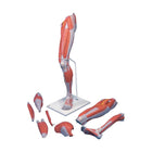 Beinmuskulatur, Luxusversion, in 7 Teilen - Anatomie und Pathologie